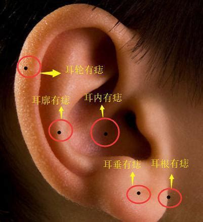 耳朵裡有痣|耳朵长痣的位置图解 耳朵长痣的位置图解有福气